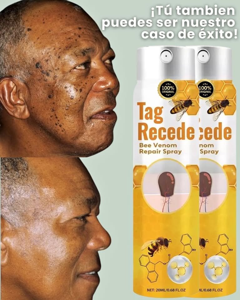 Tag Recede Eliminador de Verrugas